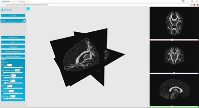 Fiberweb: Diffusion Visualization and Processing in the Browser